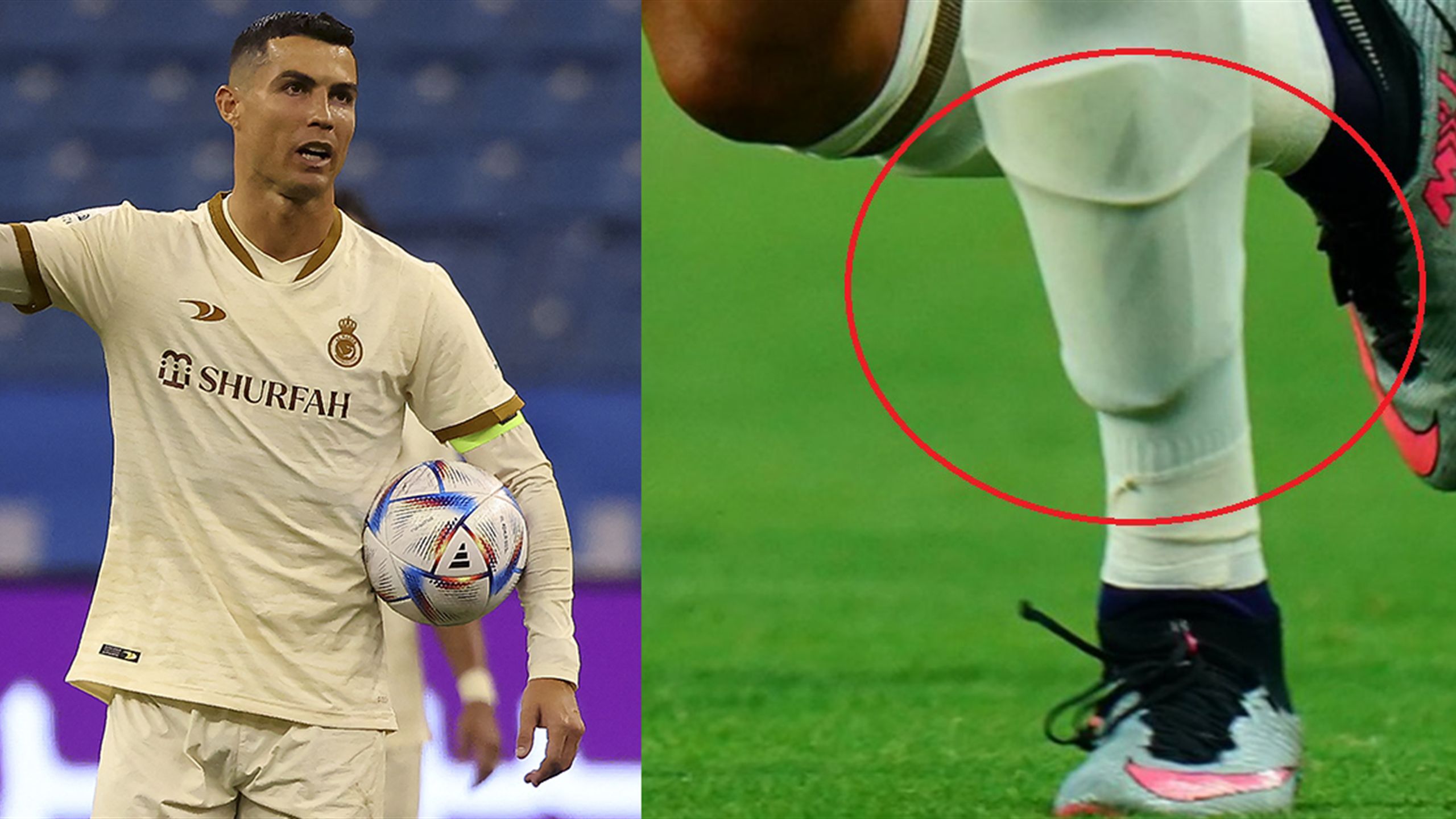 Ronaldo e il giallo del parastinco che ha fatto infuriare la Nike