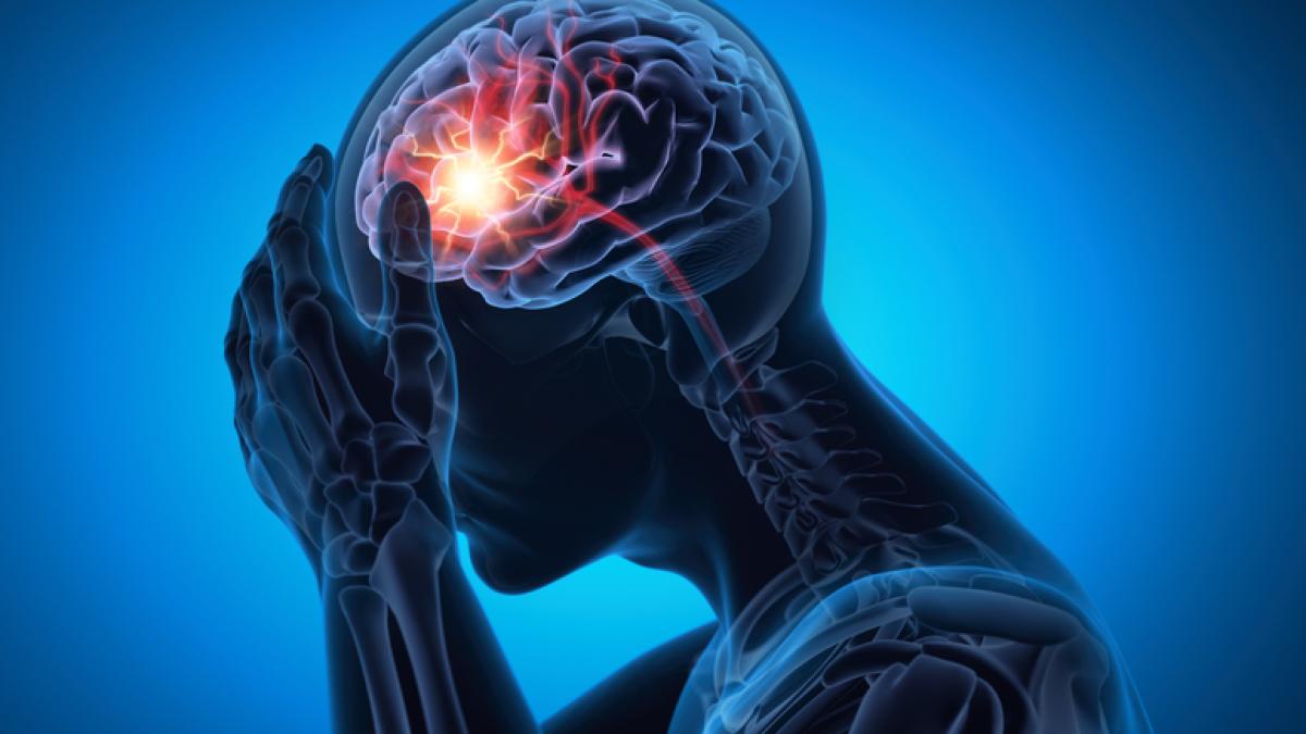 L'ictus si potrà "congelare" grazie a un mix di farmaci che blocca i danni al cervello
